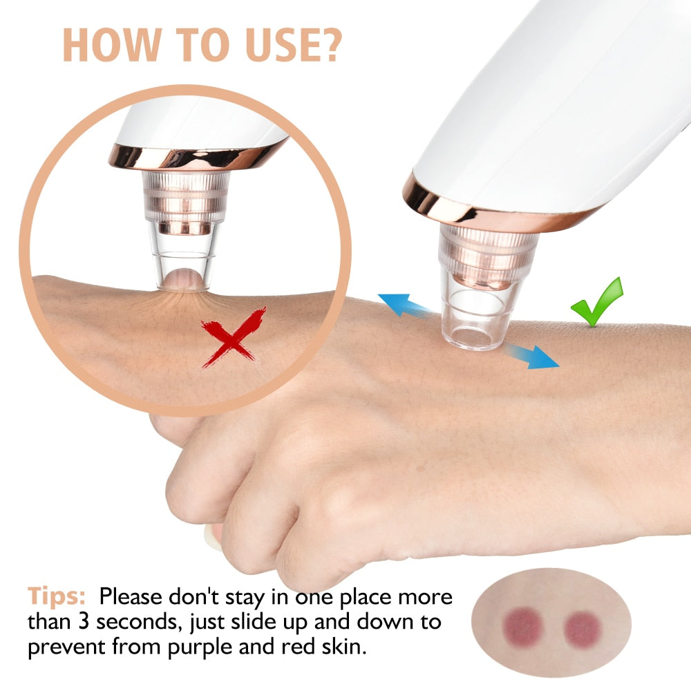 Blackhead Remover Vacuum Acne Pimple Black Spot Suction Electric Facial Pore Cleaner Skincare Exfoliating Beauty Instrument - Mammalook